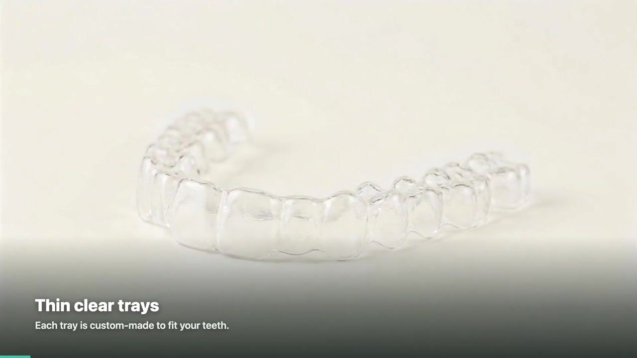 Clear Aligners — 3D patient education video
