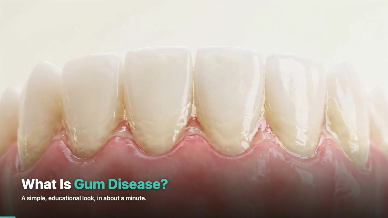 Gum Disease — 3D patient education video